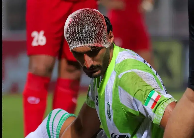 مدافع خیبر در دیدار مقابل نساجی دچار شکستگی سر و جراحت صورت شد